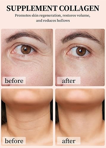 Miniatura 4 de Wrinkle Bounce Multi Balm Stick Korean, bálsamo hidratante todo en uno, bálsamo hidratante de colágeno hidratante en barra, bálsamo facial compacto