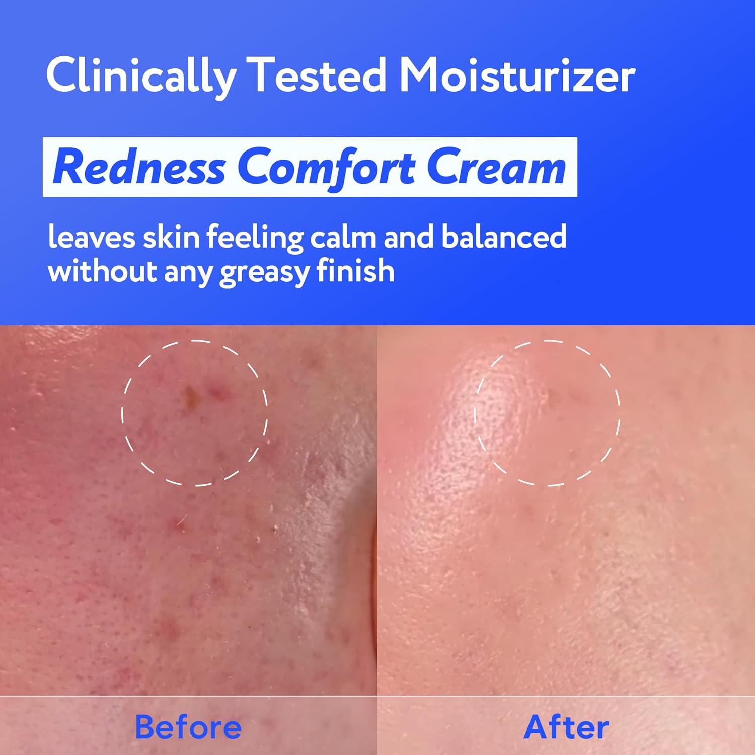 Coconut Hydro Barrier Cream | Soothing & Barrier Repair Moisturizer with Panthenol, Ceramide & Squalane | Non-Greasy, Fragrance Free Capsule Cream Korean Skin Care (80ml / 2.7 fl oz) - Image 4