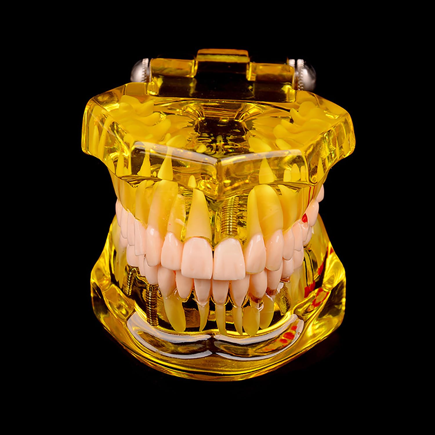 Pomarańczowy zdejmowany model zębów dentystycznych, model dentystyczny, nauczanie chorób zębów, model zębów implantologicznych, do komunikacji lekarz-pacjent