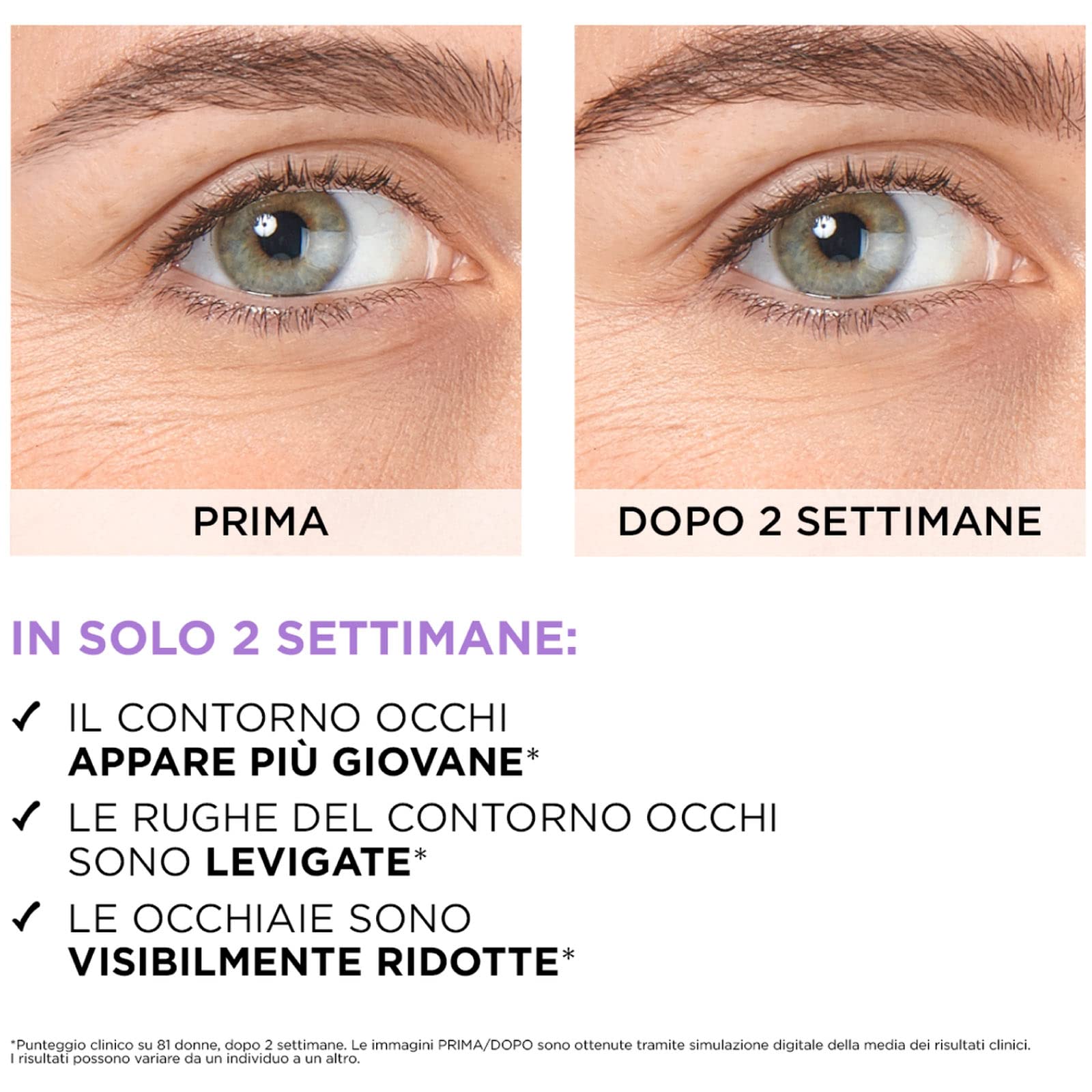 L'Oréal Paris Revitalift Filler Trattamento Anti-Rughe Rivolumizzante Giorno Crema Viso con Acido Ialuronico + Revitalift Siero Contorno Occhi Effetto Rinfrescante con Caffeina da 20ml - 2 Prodotti
