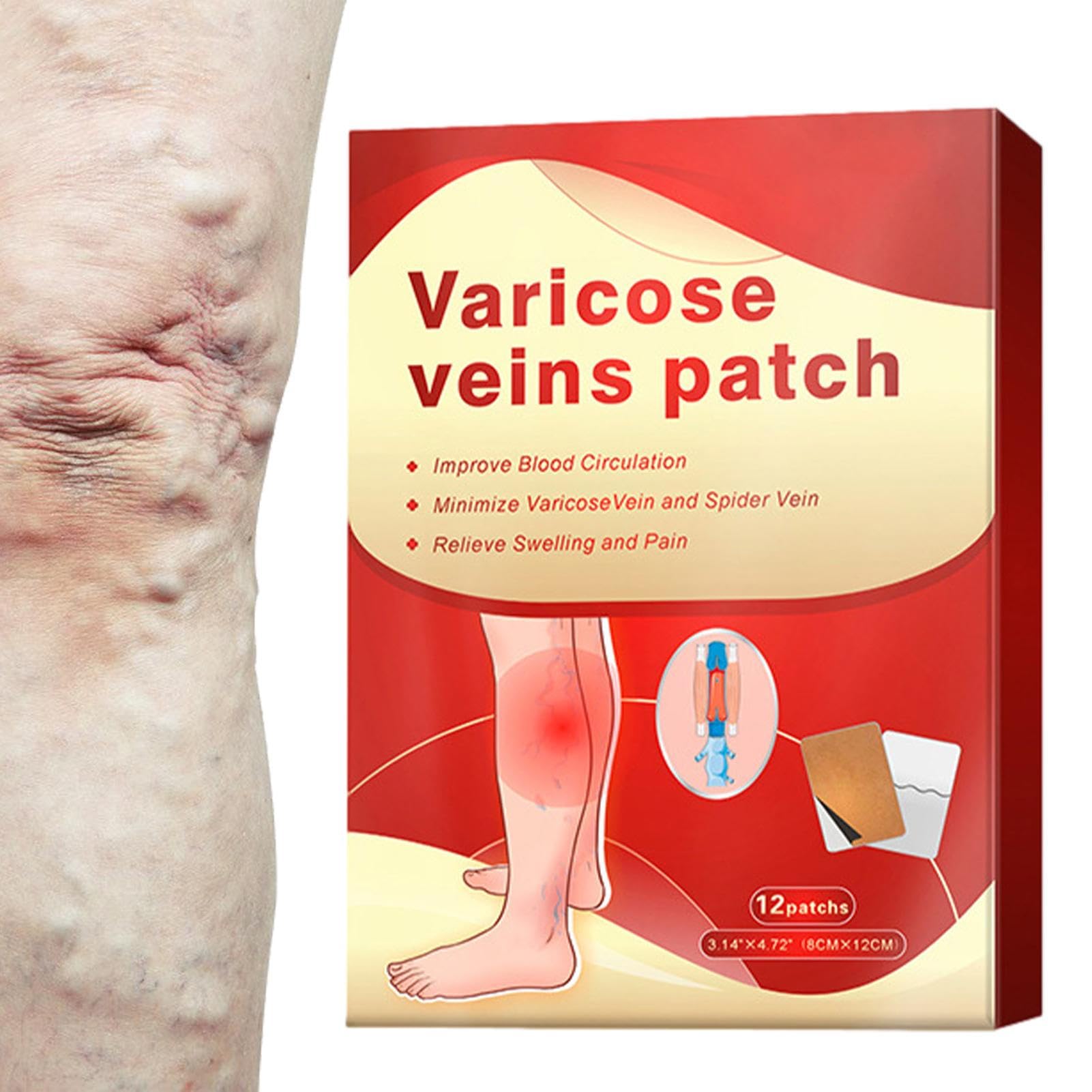 Parche de microagujas Vein Target: pasta para la circulación de 12 piezas, reducción de la hinchazón varicosa, aplicación externa para la salud, mejora la circulación, reduce la hinchazón de las piern