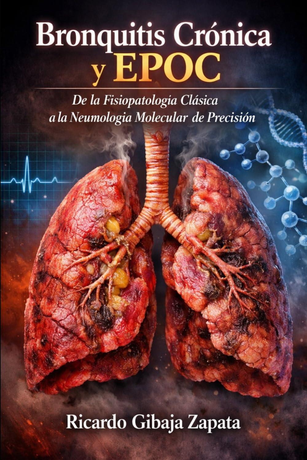Bronquitis Crónica y EPOC De la Fisiopatología Clásica a la Neumología Molecular de Precisión
