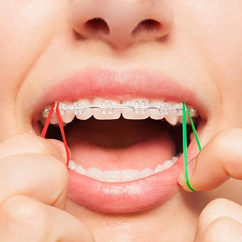 Miniatura 10 de JMU Bandas de goma de ortodoncia 18 medianas, paquete de 100 bandas elásticas intraorales de neón sin látex, bandas de goma dentales fabricadas en