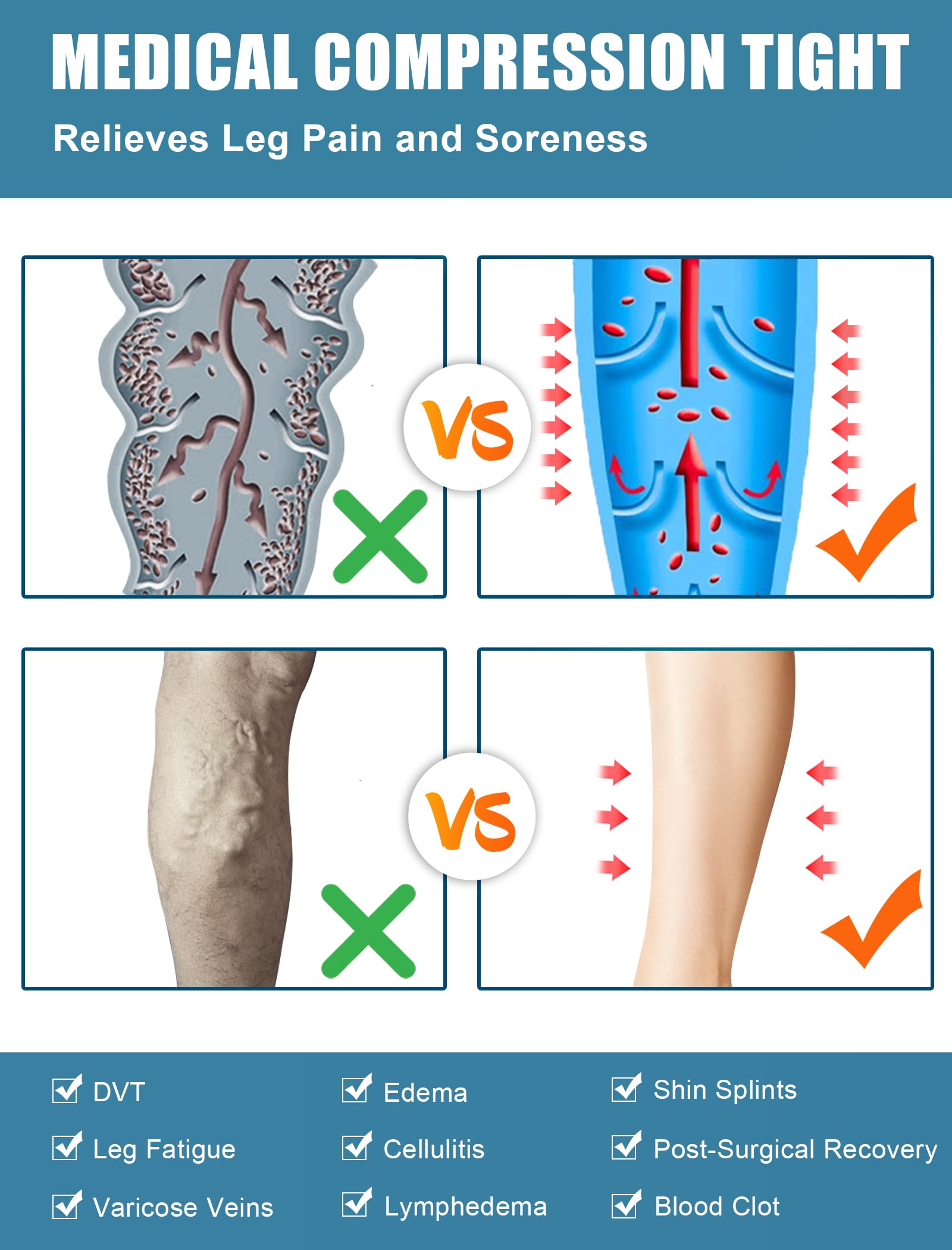 20-30 mmHg Bas de compression médicaux pour homme et femme Classe II Cuisse Chaussettes de compression longues sans pieds avec bande en silicone pour un soutien gradué des varices