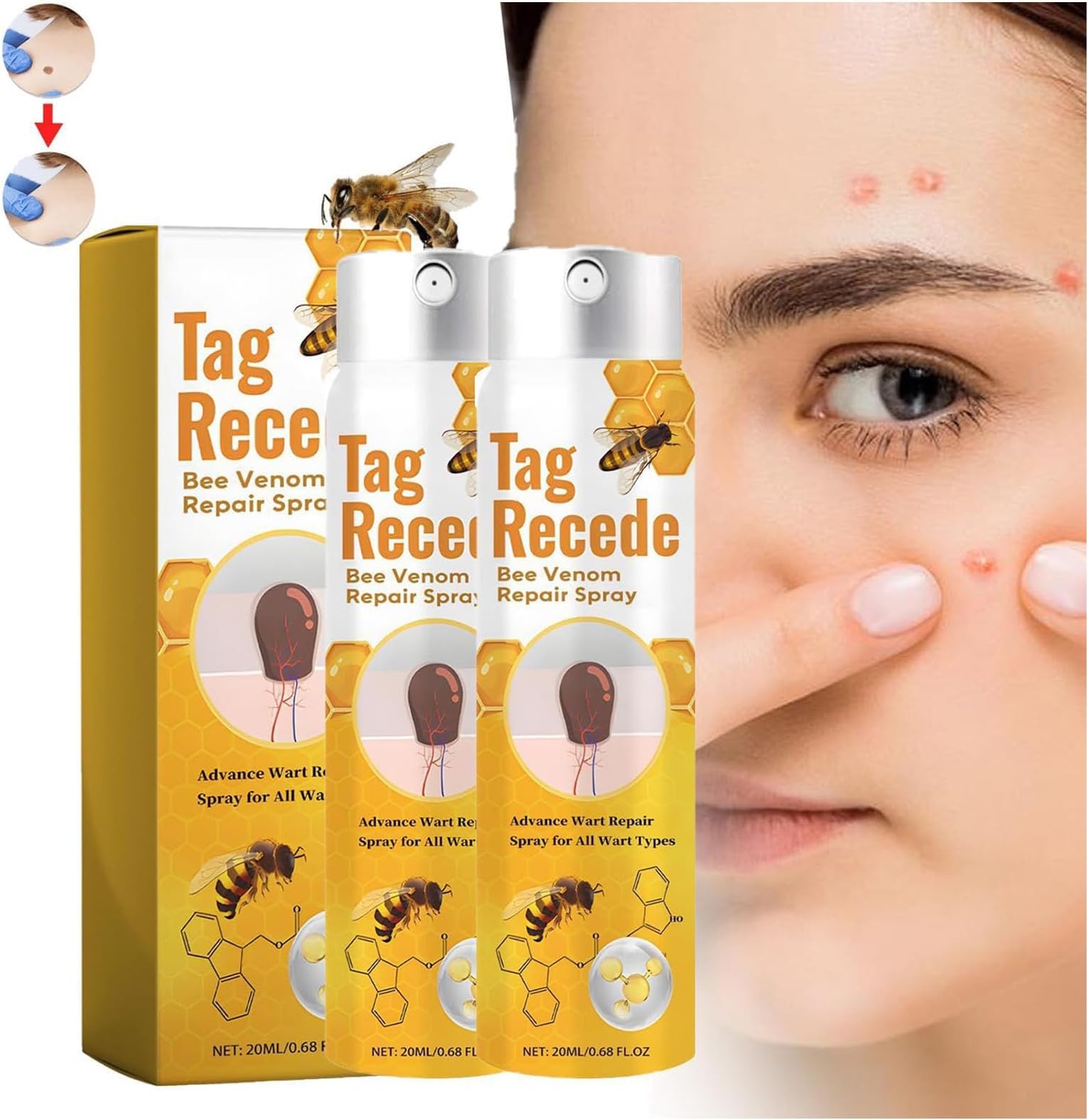 Tag Recede Bee Venom, Tag Recede Bee Venom Treatment Spray, Tag Recede, Bee Venom Spray, Tag Recede Bee Venom Spray, for All Skin Types 20ml (2pcs)