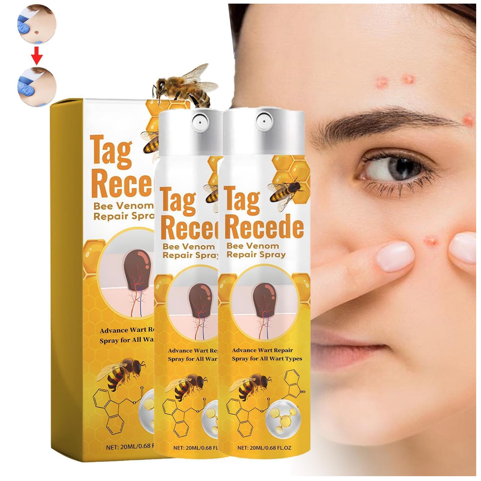 Tag Recede Bee Venom, Tag Recede Bee Venom Treatment Spray, Tag Recede, Bee Venom Spray, Tag Recede Bee Venom Spray, for All Skin Types 20ml (2pcs)
