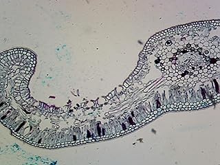 Gymnosperms Cycads, Cycas Leaf - Microscope Slide