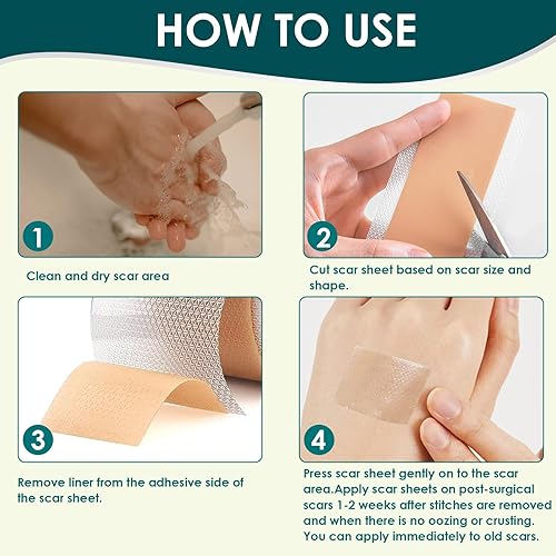 Miniatura 6 de Cinta de silicona para cicatrices, láminas de gel de silicona premium (rollo de 1.6 x 60 pulgadas - 4.9 ft), parches de silicona reutilizables,