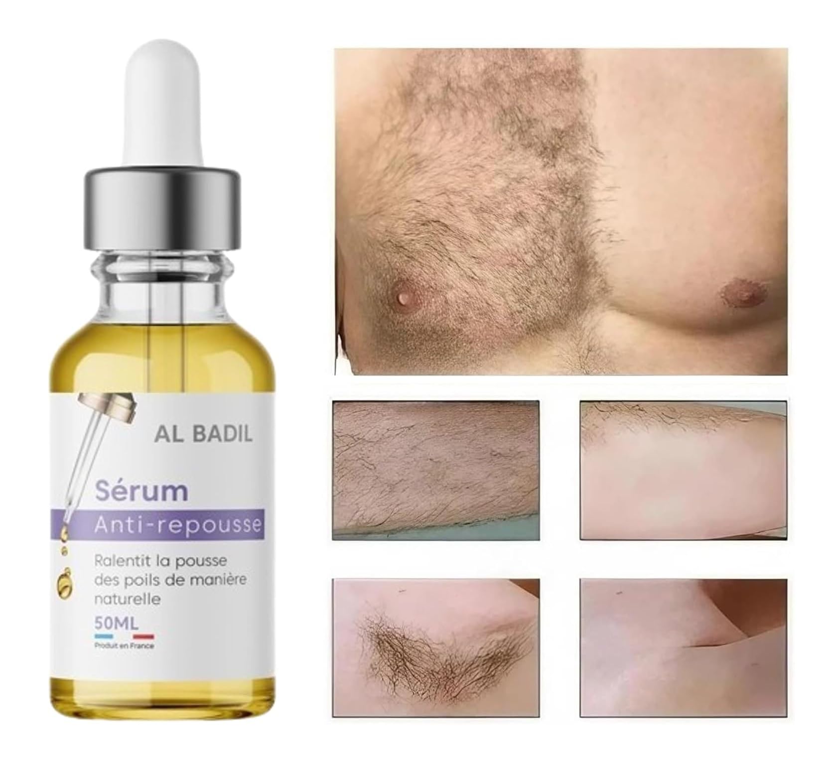 Sérum Anti-Repousse Poils - Inhibiteur 100% Naturel pour Femme et Homme, Indolore, Résultats Rapides, Lutte contre les Poils Incarnés "Made in France"