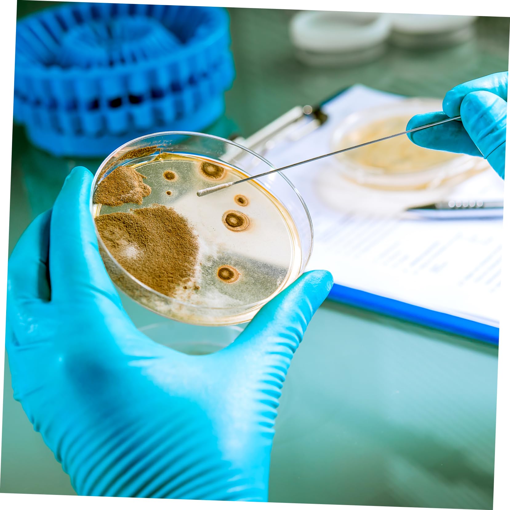 Anneome 20piezas Placas De Agar Prevertidas Para Experimentos Científicos Placas Petri Con Agar Para Cultivo Microbiano Y Proyectos De Feria De Ciencias