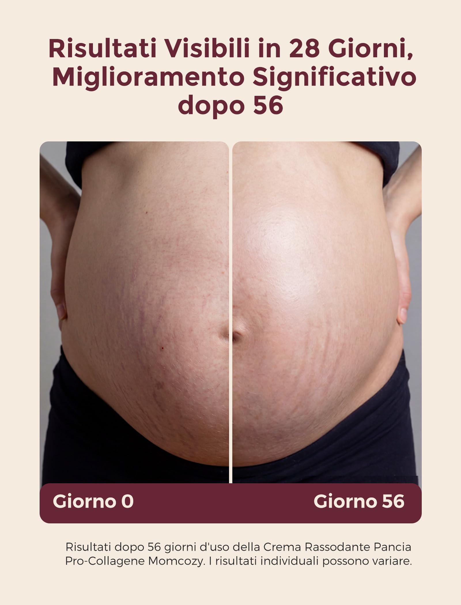 Momcozy Crema Smagliature e Rassodante Pancia 4-in-1,Trattamento con Peptidi Pro-Collagene,Idratante, Rassodante ed Elasticizzante per Gravidanza e Post Parto,150g