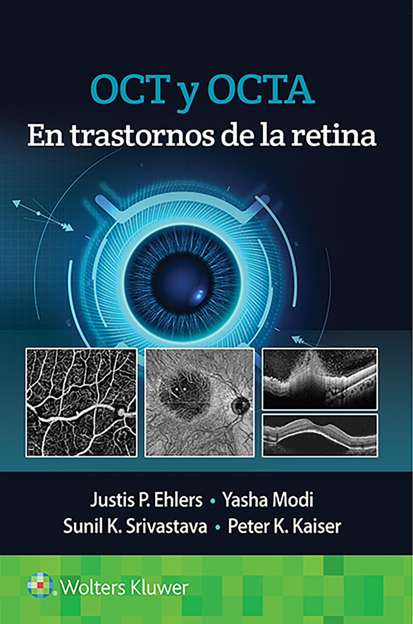 OCT y OCTA en trastornos de la retina (Spanish Edition)