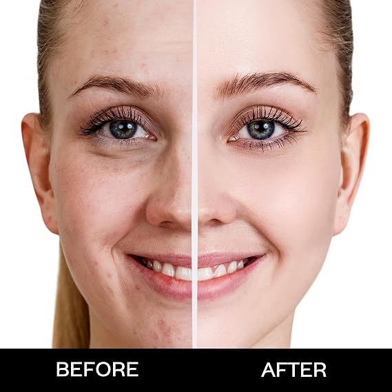 FACES CANADA Weightless Matte Finish Foundation - Beige 03, 18 ml | Ultra Blendable Smooth Texture | Natural Matte Finish | Anti-Ageing | Grape Extract, Shea Butter, Olive Seed Oil Enriched