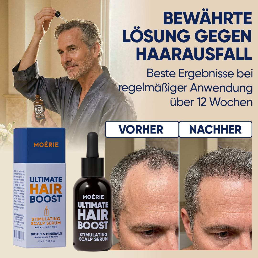 MOERIE Hair Growth Serum - zum Haarwachstum beschleunigen & gegen Haarausfall bei Frau - Haarwuchsmittel Kopfhaut Serum - Haar Wachstum Haarserum Öl - Anti Haarausfall Haaröl