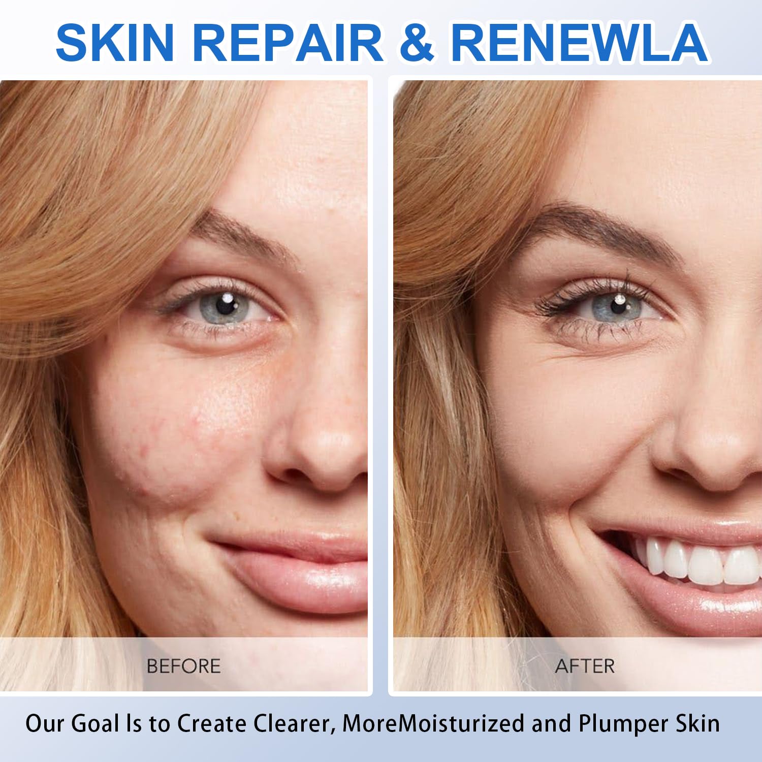 5% Hyaluronic Acid Serum Ultra-Moisturizing Vials,Hyaluronic Acid Facial Serum, Single-Use Hyaluronic Acid Tubes,Intensive Hydration,Enhances Skin Elasticity,Pre-Makeup Moisturizing Care (1 Box of 30) - Image 6