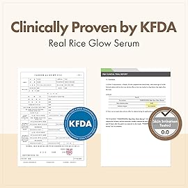 TOSOWOONG Real Rice Glow Serum with 80% Rice Bran Water and Niacinamide for Dark Spots, Uneven Skin Tone, Dull Skin, Radiant Glow, and Daily K-Beauty Skincare for All Skin Types, 33ml / 1.11 fl. oz.