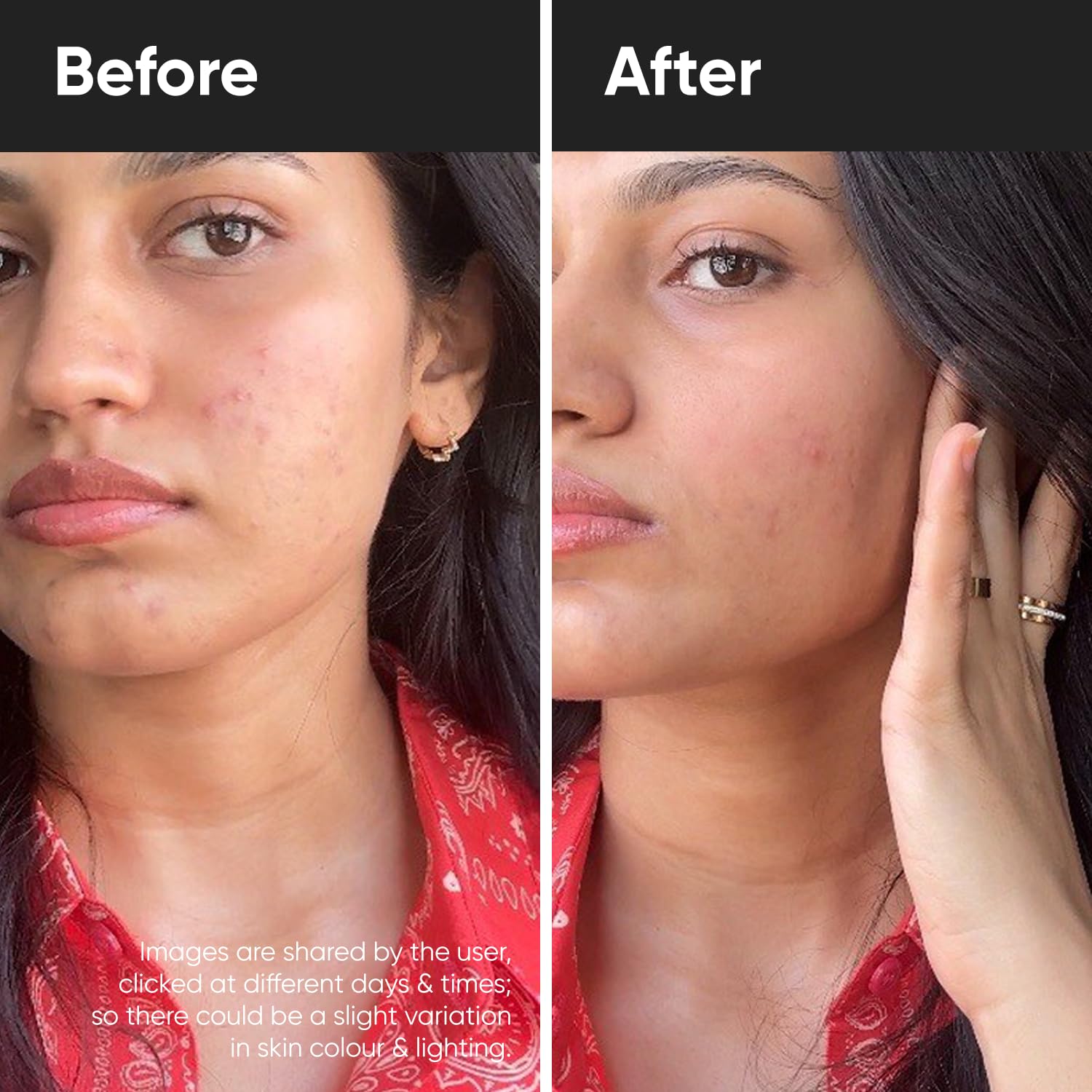 Herbal max Nutraceutical L Glutathione Tablets for Skin Whitening With Vitamin C - 30 Tablets |L Glutathione & Vitamin C | Sugar-free Antioxidant & Skin Glow Supplement for Skin Clarity | Herbal max Nutraceutical L Glutathione Tablets for Skin Whitening With Vitamin C - 30 Tablets |L Glutathione & Vitamin C | Sugar-free Antioxidant & Skin Glow Supplement for Skin Clarity |