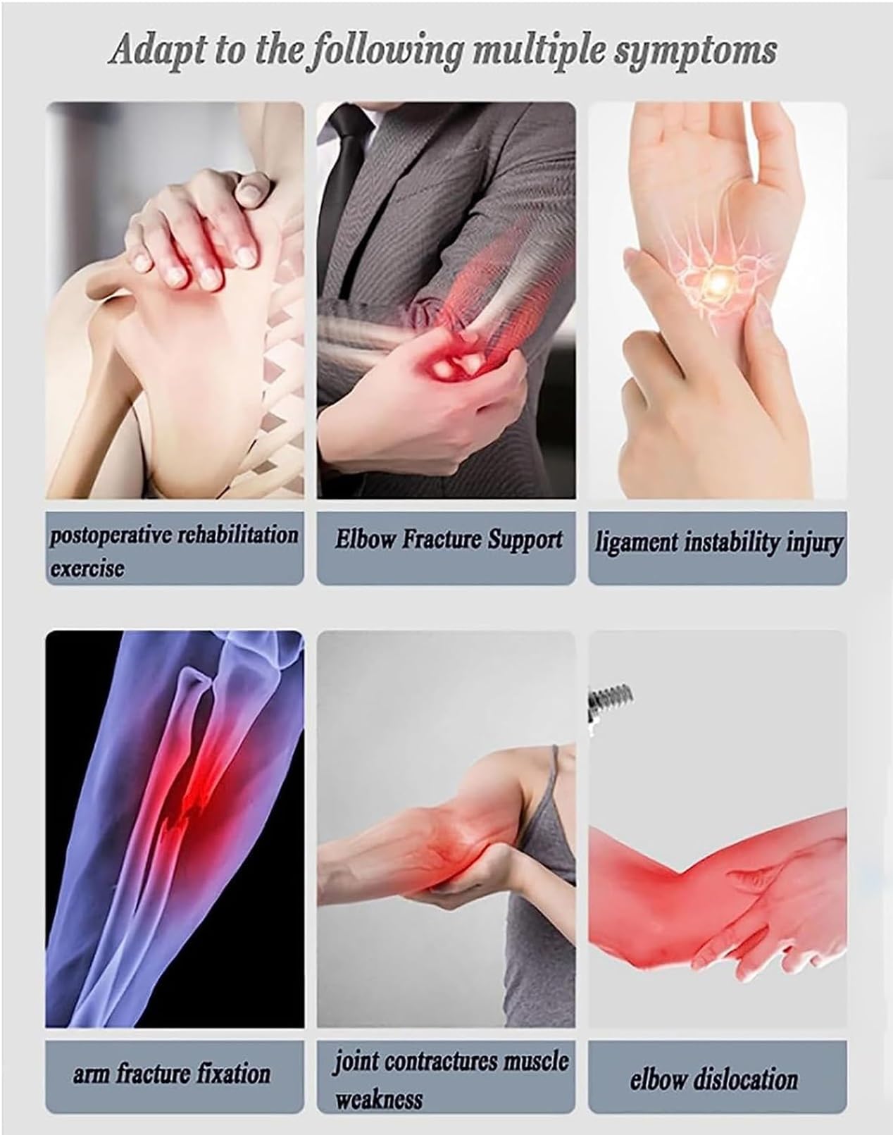 Soporte de Inmovilización de Codo Ajustable Equipo de Rehabilitación Soporte de Corrección de Fractura de Brazo for Lesiones de Codo Lesiones de Ligamentos Fracturas Artritis