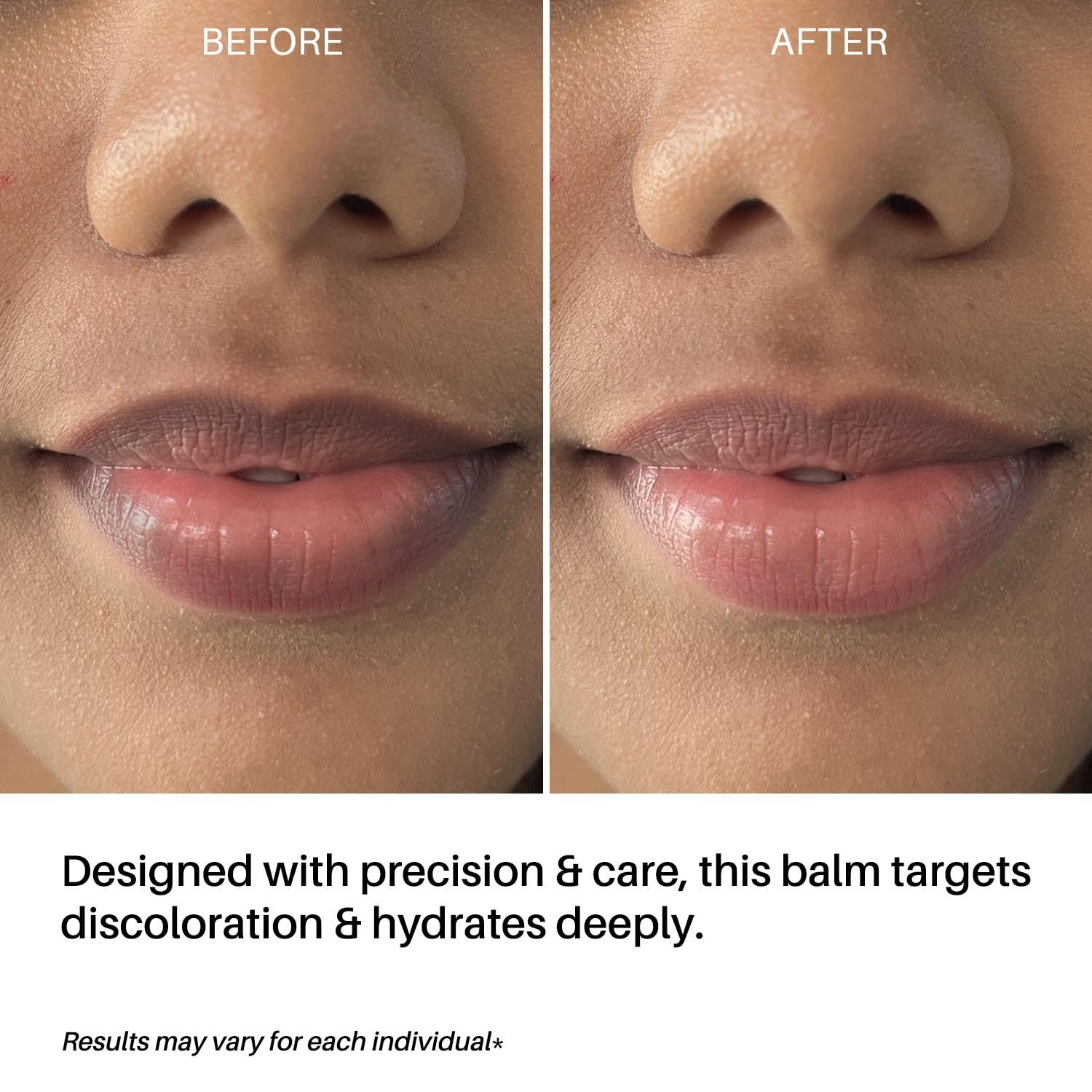 DERMDOC LipBright Treatment with 1% Glutathione + 2.5% Arbutin Lip Balm, 10 gm | Brightens Lip | Reduces Pigmentation | For Dry & Chapped Lips | Lightweight | Non - sticky 1