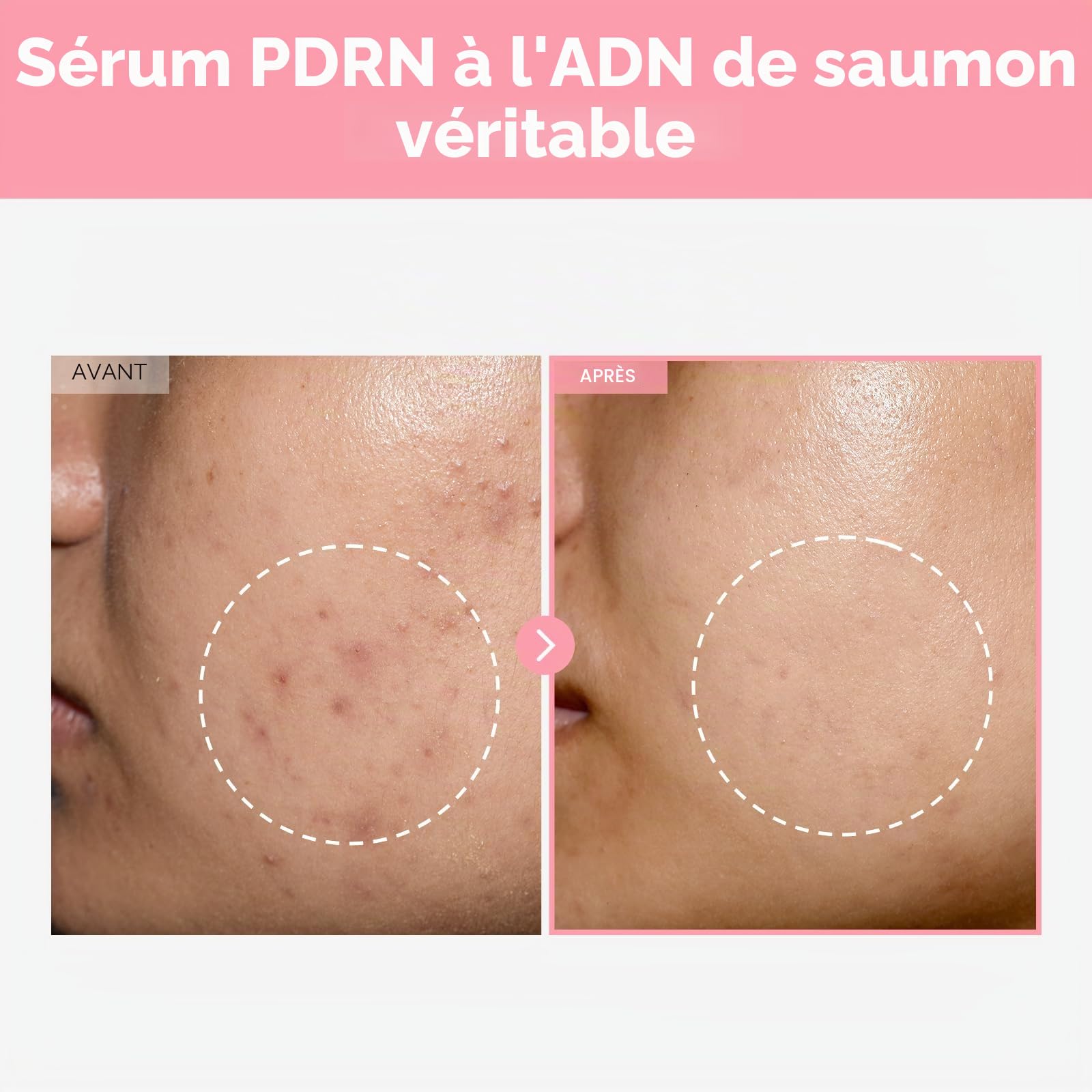 Duo Affinant le Teint K-Beauty TOSOWOONG : Crème Arbutine 7 Acide Tranexamique 4 et Sérum Pink Peptide 12 PDRN | Pour Teint & Texture Inégaux | Set Hydratant et Raffermissant