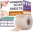 Silicone Scar Sheets,Silicone Scar Tape,Silicone Scar Removal Strips for Surgical,C-Section,Tummy Tuck,Keloid Scars (1.6"X 59" Roll-1.5M) Keloid Bump Removal