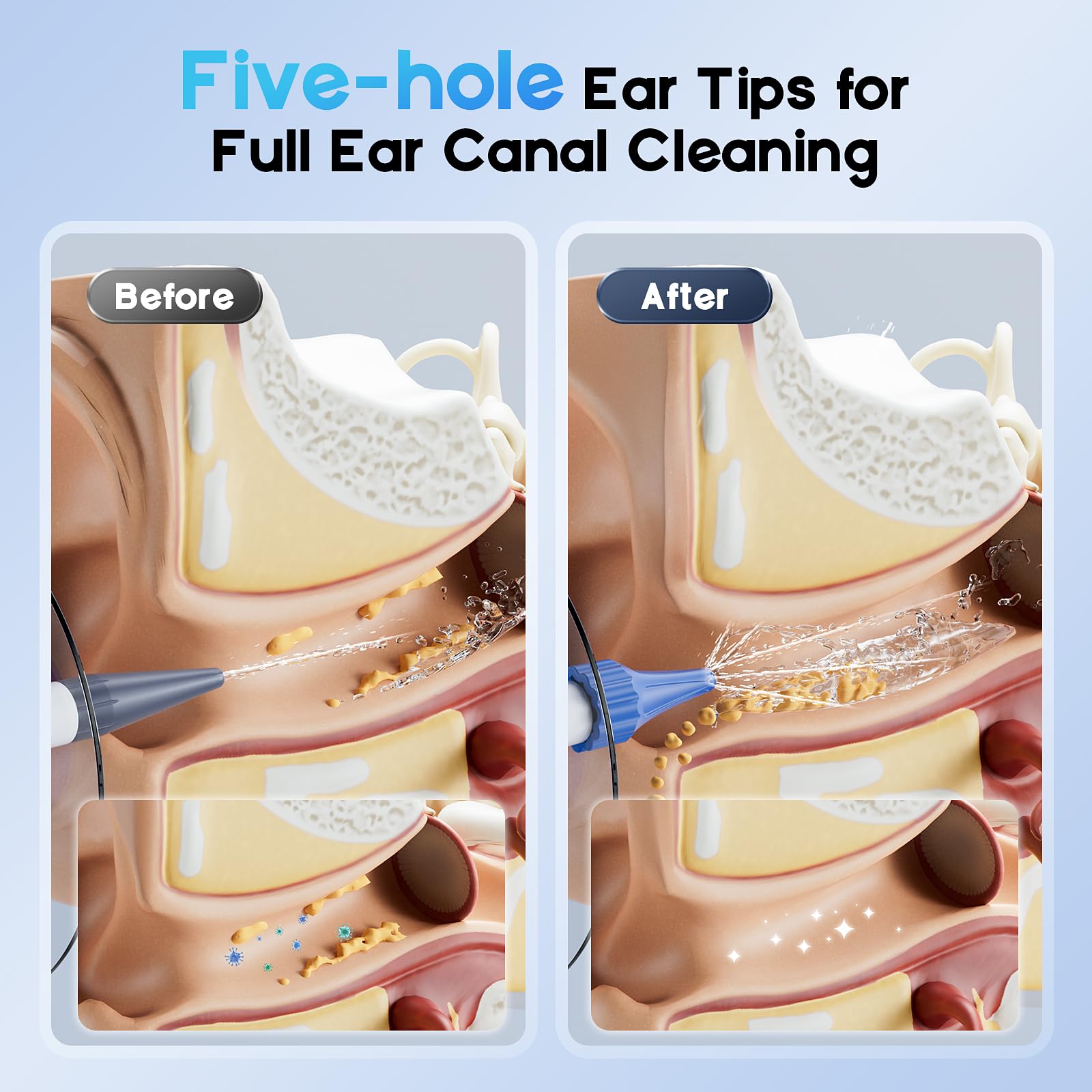 Electric Ear Wax Removal Kit for Adults with 4 Cleaning Modes, Home Use — Amazon image 4