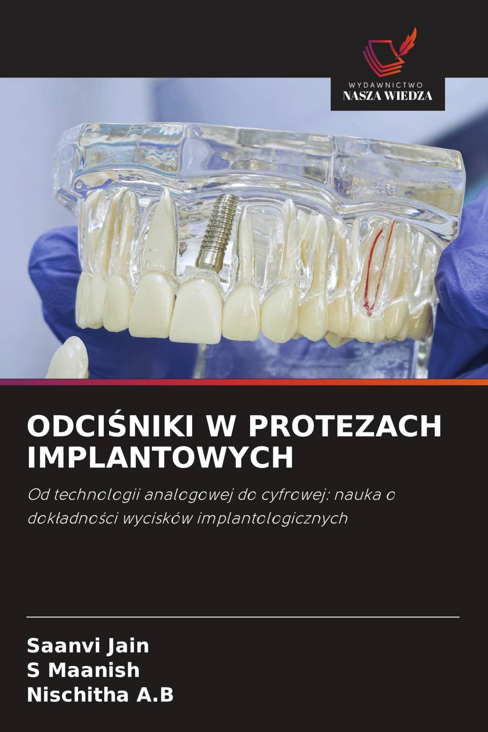 ODCI¿NIKI W PROTEZACH IMPLANTOWYCH: Od technologii analogowej do cyfrowej: nauka o dok¿adno¿ci wycisków implantologicznych