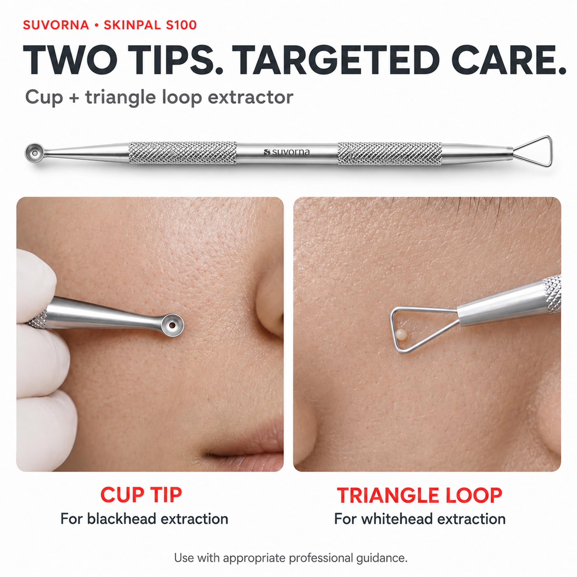 Suvorna Pimple Popper Kit - Acne Extraction Tools -4 Suvorna Pimple Popper Kit - Acne Extraction Tools -4