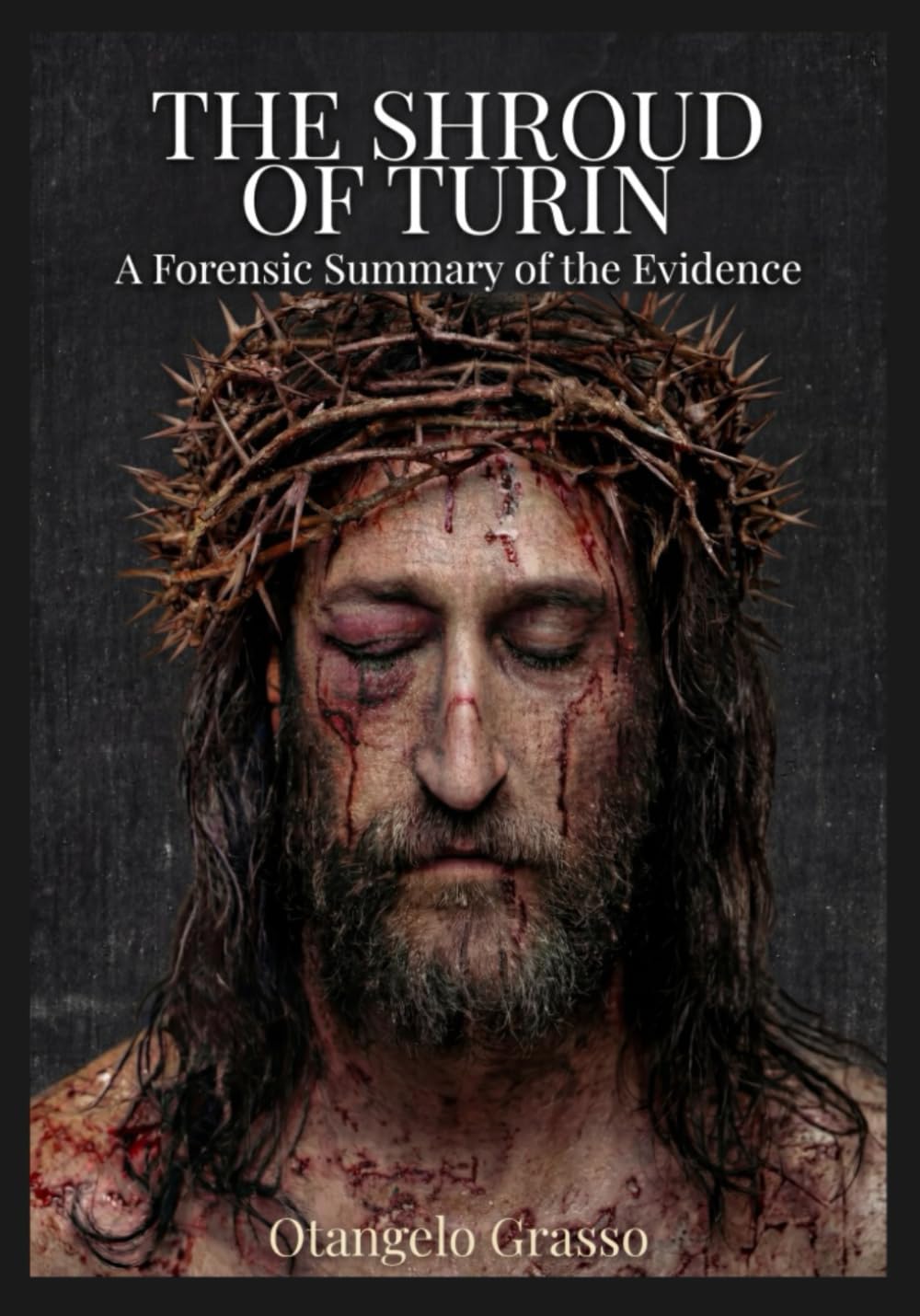 The Shroud of Turin: A Forensic Summary of the Evidence