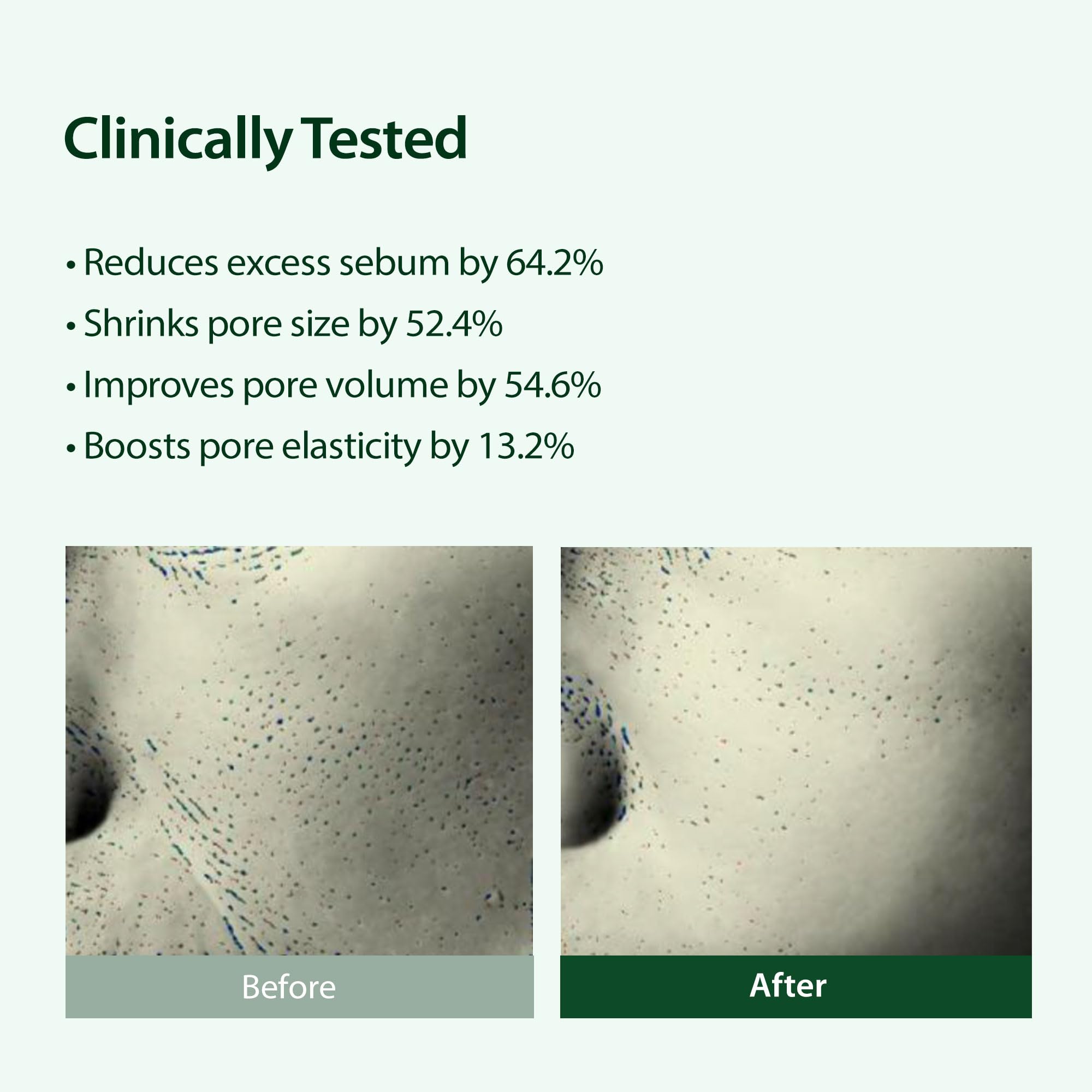 BLITHE Targeted Pore Serum with 22% Niacinamide, 1 fl oz