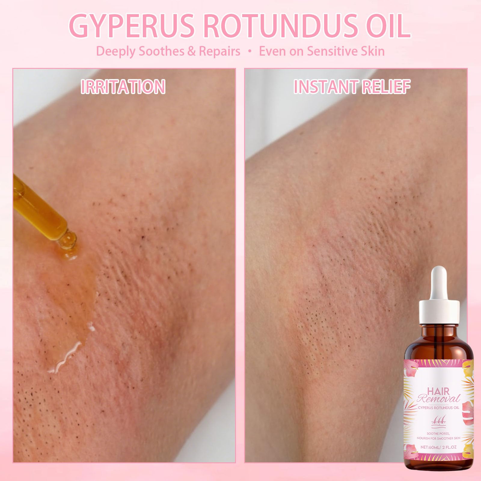 Cyperus Rotundus Oil, 2 butelki z olejkiem Cyperus Rotundus, olejek Rotundus, hamuje wzrost włosów na ciele, nawilża i koi skórę, w zestawie 1 golarka