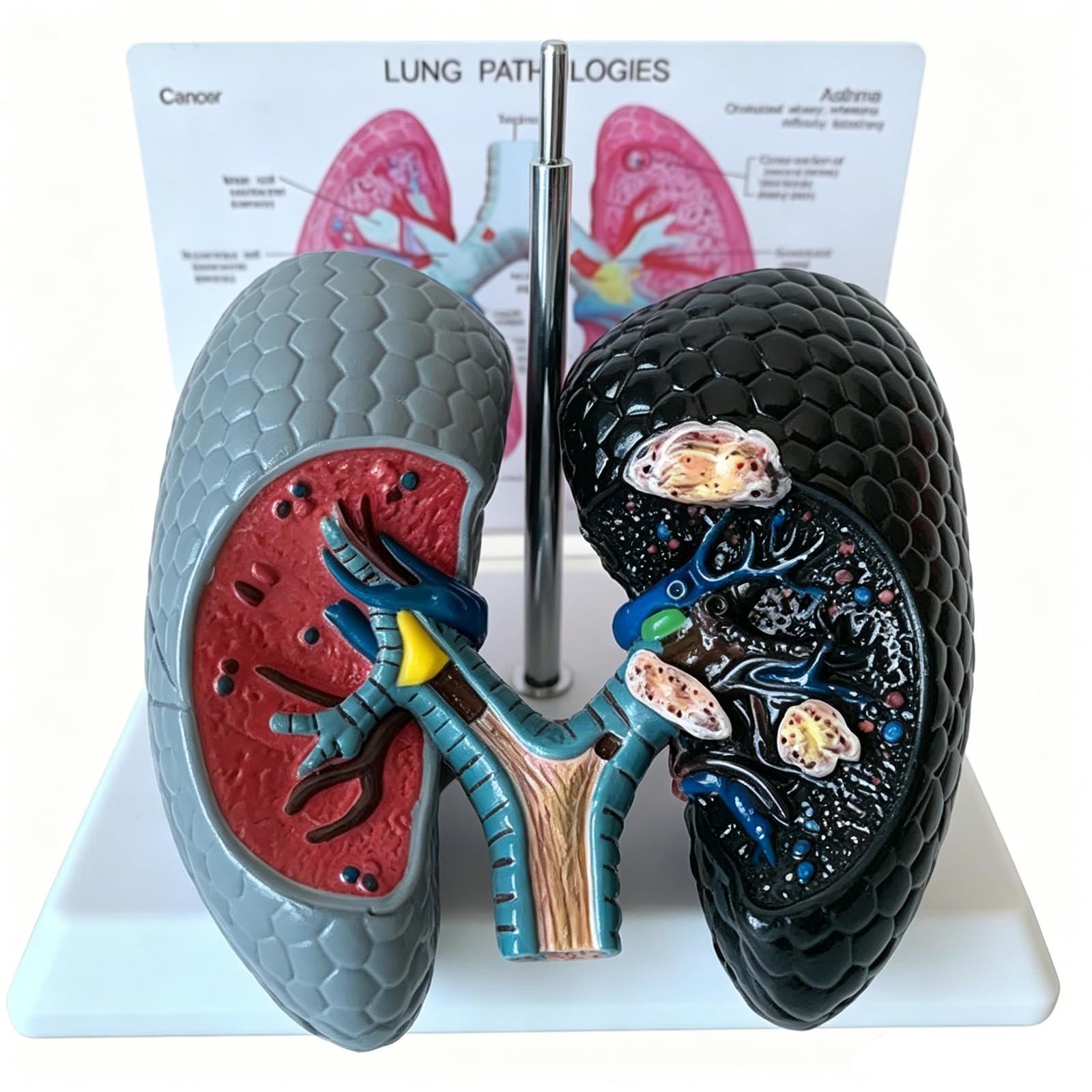 WHOOLEFUN Human Health and Smoking Lung Comparison Model, Healthy VS Smoking Bronchopulmonary Anatomy Display, with English Back Card, for Health Education
