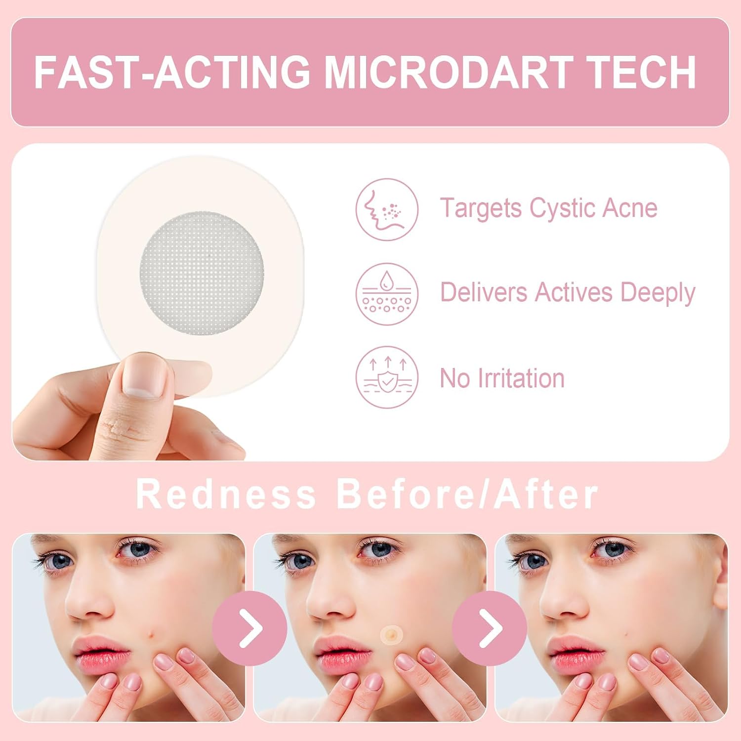 Pimple Patches Set with Microdart Style & Hydrocolloid Patches – 3-Step Blemish Care Kit for Clearer-Looking Skin, Zit Patches for Face, Includes Hygiene Tools