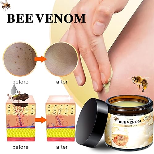 Miniatura 8 de Bee Venom Crema de tratamiento de la piel, eliminación de la piel y cuidado de la piel para cara y cuerpo para todo tipo de piel, rápida y eficaz (1
