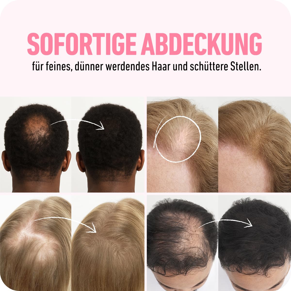 BOLDIFY Haarfasern für dünner werdendes Haar, für Damen & Herren, Dunkelblond 56g