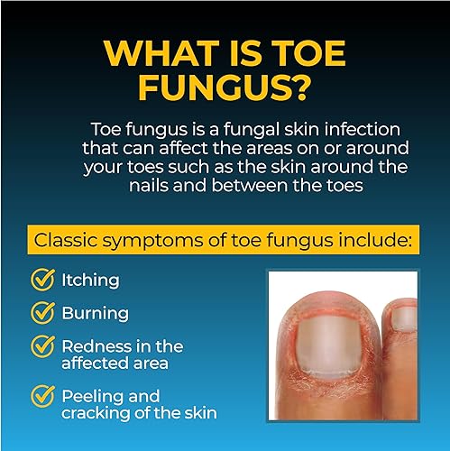 Miniatura 4 de Fungi-Nail Solución líquida antihongos mata hongos que pueden conducir a uñas y pie de atleta con tolnaftato y clínicamente probado para curar y