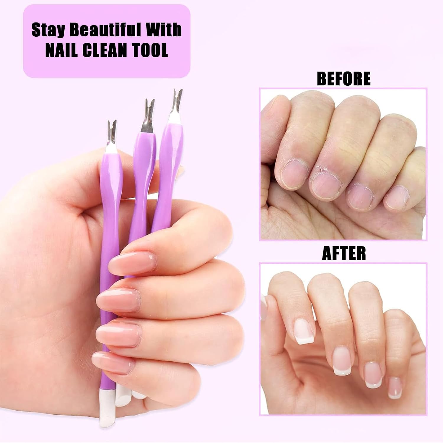 5 Pcs Cuticle Trimmer Pusher Remover, Rubber Tip Gentle on Nail Bed,Manicure Tool for Home and Nail Shop(Purple)