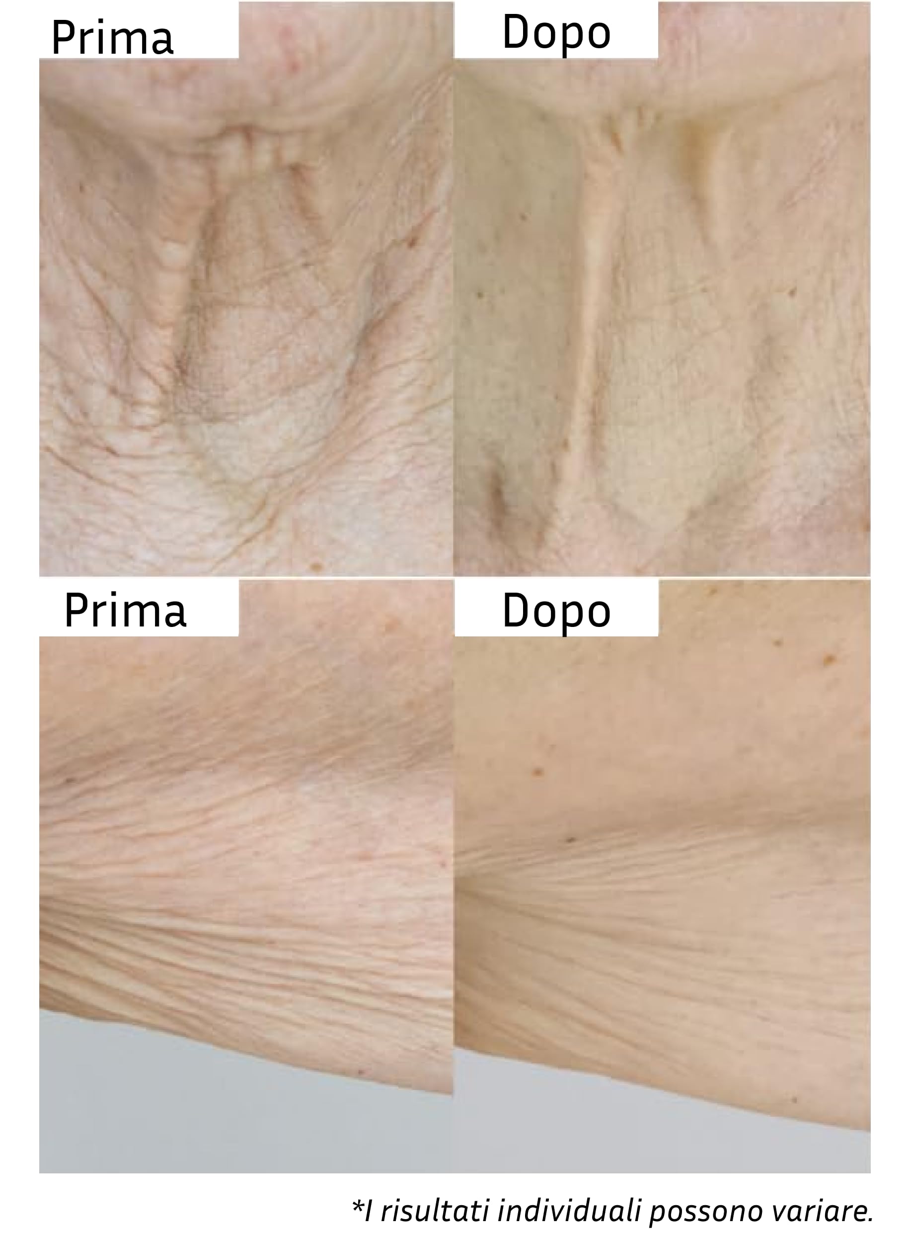 City Beauty InvisiCrepe Body Balm - Lozione rassodante e tonificante per una pelle più liscia e compatta | Crema corpo rassodante antietà