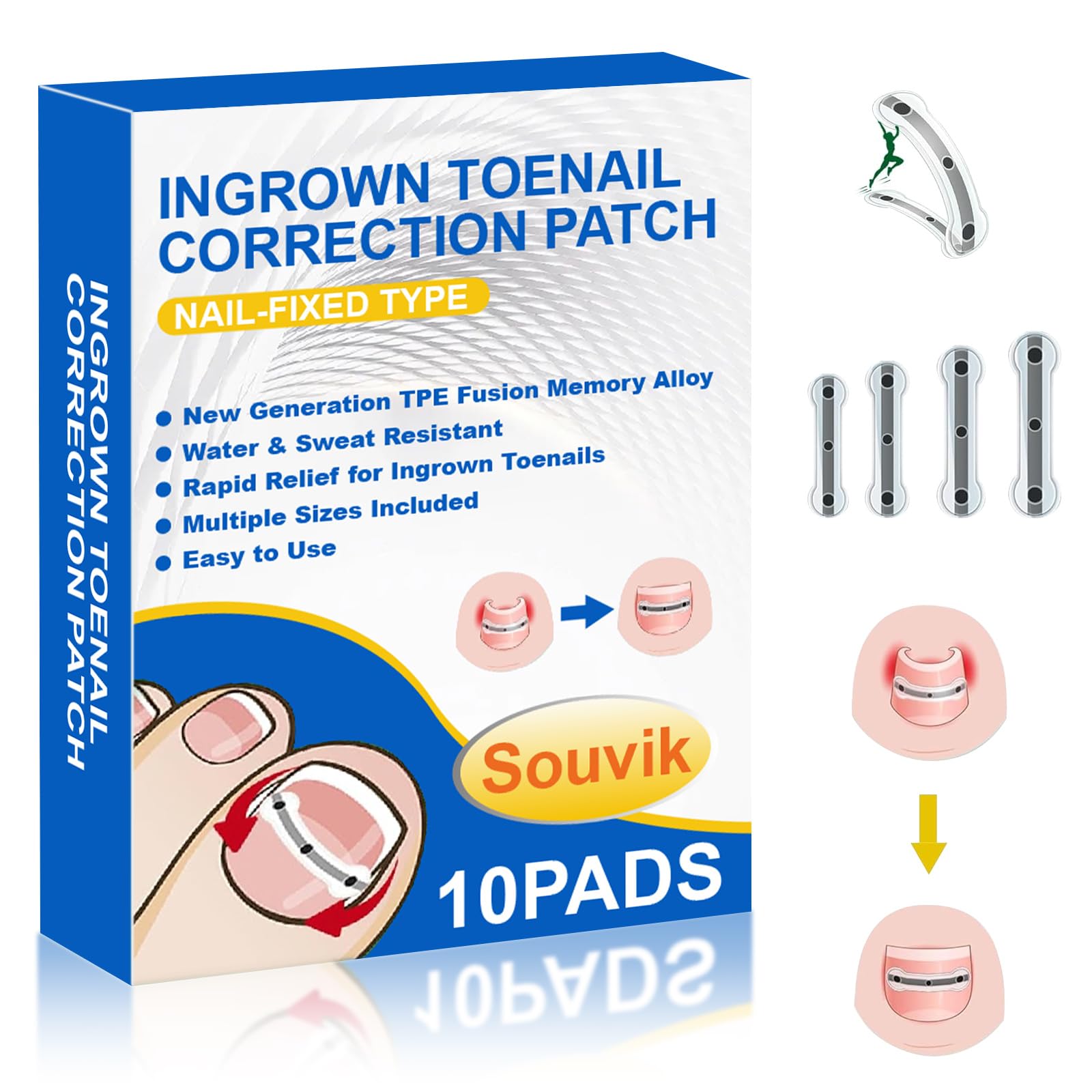 Souvik Set di unghie incarnite, correggere le unghie incarnite, fermaglio correzione delle unghie dei piedi, per uso domestico - Uomini e donne, 10 pezzi, 17/18/19/20 mm