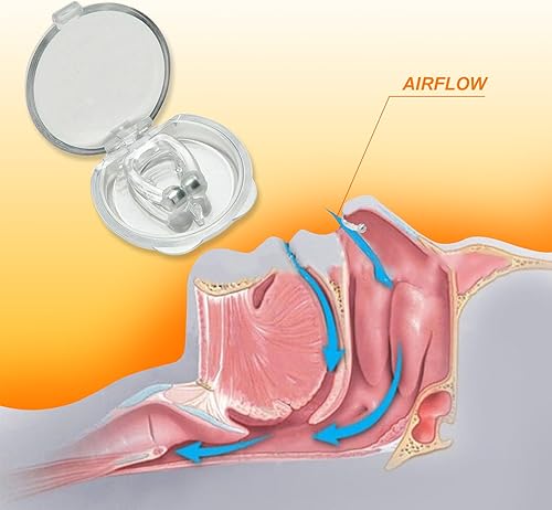 Miniatura 4 de Dispositivo antironquidos para diferentes tipos de ronquidos (paquete de 30) - Viene con rejillas de ventilación, clips de nariz y tiras nasales -