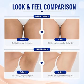 Skin Whitening Cream, Skin Bleaching Cream for Underarms Inner Thighs Bikini Line Knees Elbows, Deep Nourishing Brightening Body Moisturiser for Dark Areas, Even Skin Tone, Soft Smooth Skin, 100g