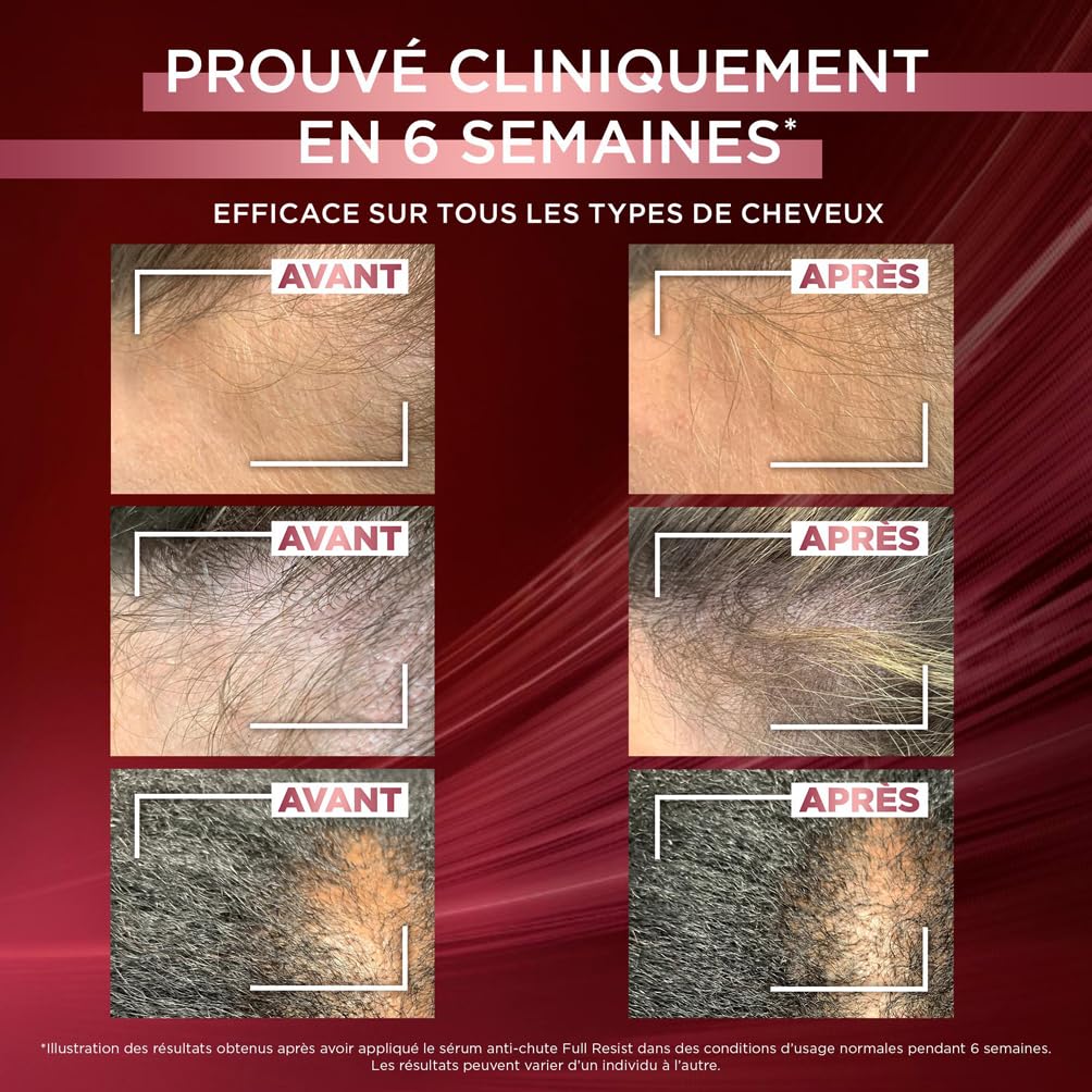 L'Oréal Paris - la Cure Anti-Chute Full Resist - Aminexil + Caféine + Arginine - Sérum - Pour Cheveux Fragiles, Perte de Cheveux - Longueurs Renforcées, Cuir Chevelu Moins Visible - Elsève - Lot de 3