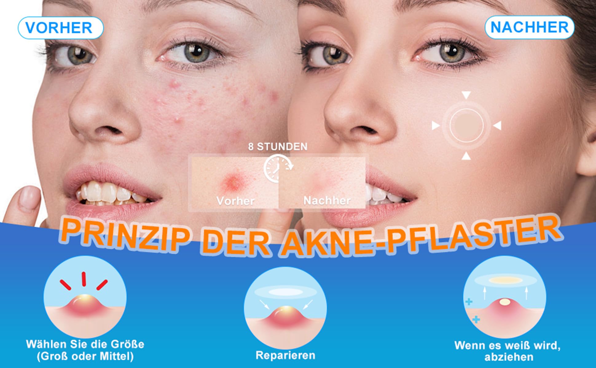 360 sztuk plastrów na pryszcze, niewidoczne, hydrokoloidowe, pryszcze, pochłaniające trądzik, plastry na trądzik z olejkiem z drzewa herbacianego, wodoodporne i oddychające wchłanianie na dzień