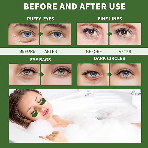 Miniatura 6 de Parches para debajo de los ojos para ojos hinchados, 70 unidades, máscara de ojos de algas marinas para ojeras e hinchazón, parches de máscara