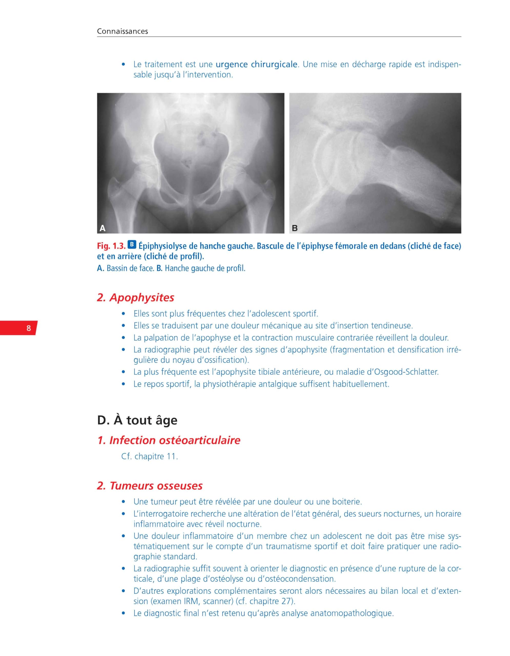 Rhumatologie: Réussir ses EDN