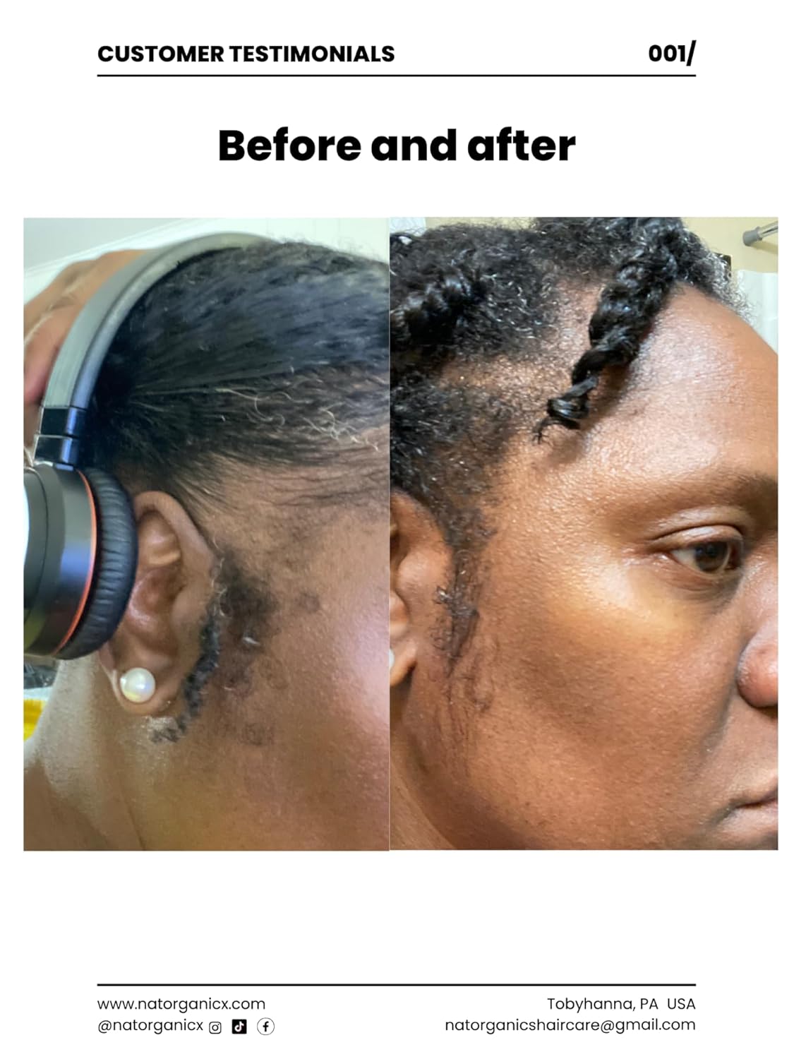 N A T Organics Max Growth Hair Elixir with Fenugreek, Amla, JBCO and Henna. Concentrated Ayurvedic oil for rapid hair growth.