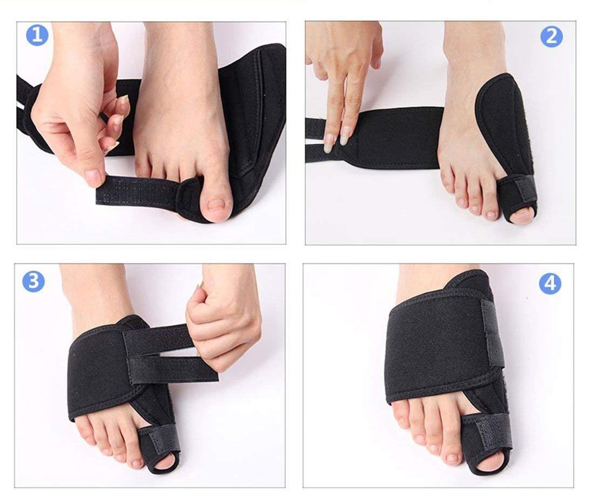 PEDIMENDTM Zehenglätter und Korrekturhilfe für Hallux Valgus Schmerzlinderung (2 Paar)