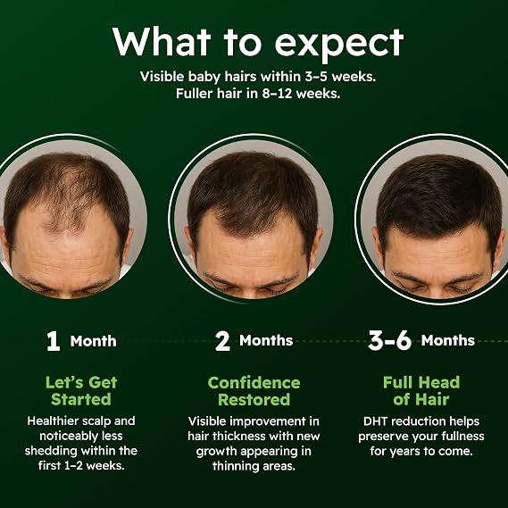 Hair Serum for Men Ginseng & Eclipta Botanical Scalp Serum