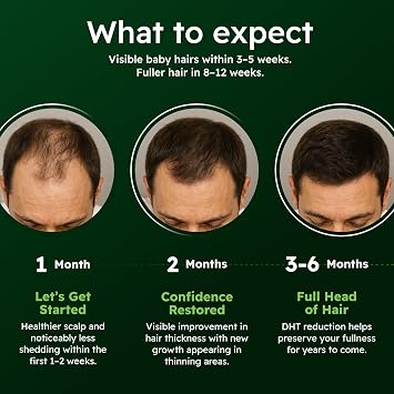 Hair Serum for Men Ginseng & Eclipta Botanical Scalp Serum
