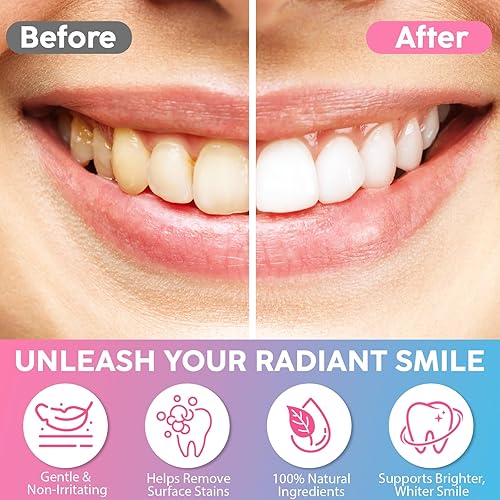 Miniatura 7 de Pasta de dientes de niacinamida, pasta dental blanqueadora intensiva de niacinamida, dientes de limpieza profunda y suave, blanquea eficazmente los